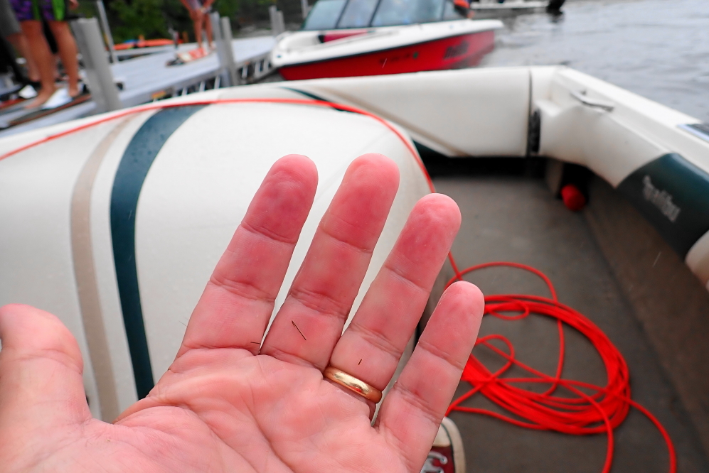 Pruney fingers became a thing among boat drivers and judges.